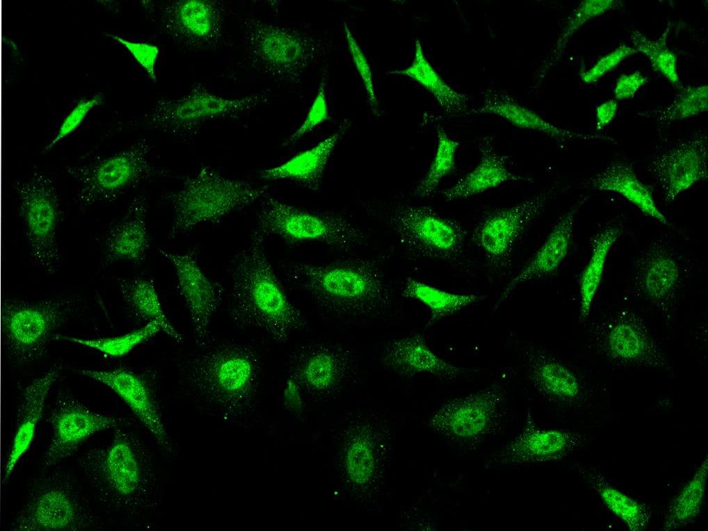 STC1 / Stanniocalcin Antibody