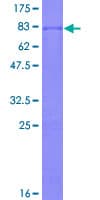 Human SMAD9 Protein (Recombinant GST)
