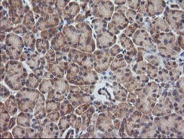 TCL / RHOJ Antibody (clone OTI1C8)