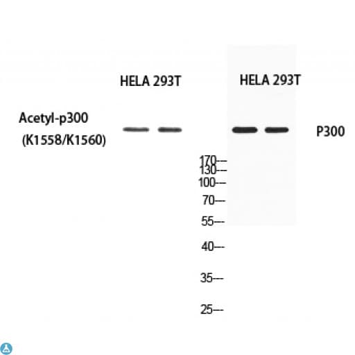 EP300 / p300 Antibody