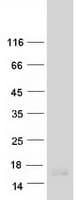Human MT2A / Metallothionein 2A Protein (Recombinant Myc-DDK (Flag))