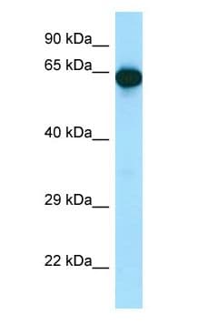 Polyclonal Rabbit anti-Mouse UTP15 Antibody (aa301-350, WB)