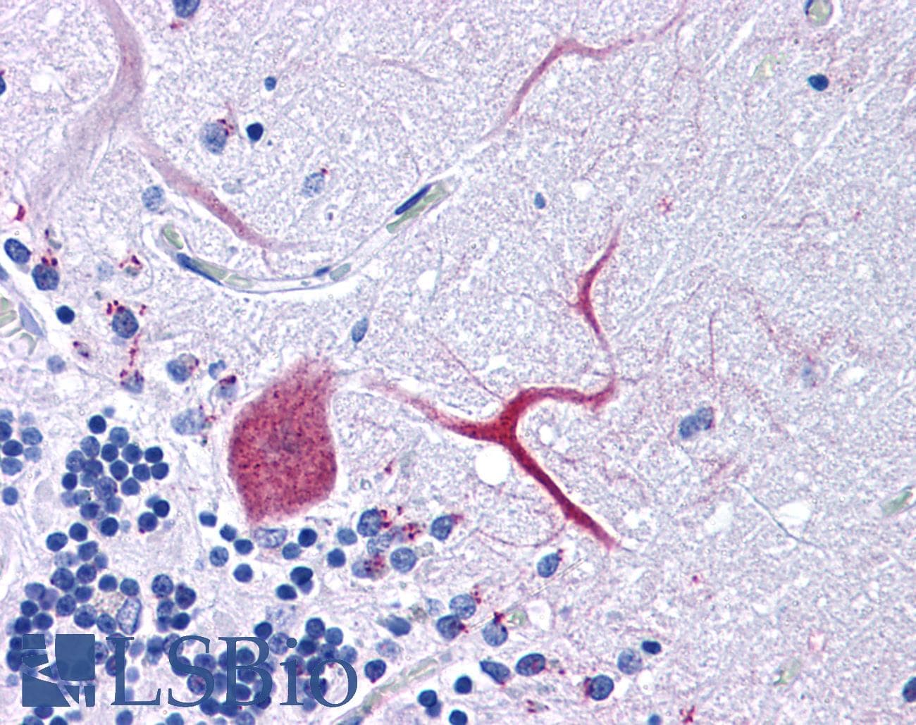 IHC-plus™ Polyclonal Rabbit anti-Human TTBK1 Antibody (IHC, IF, WB)