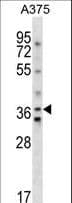 AVPR1A / V1a Receptor Antibody (aa355-383)