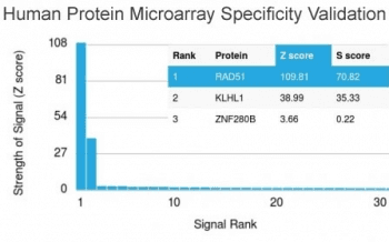 RAD51 / RECA Antibody (clone RAD51/2753)