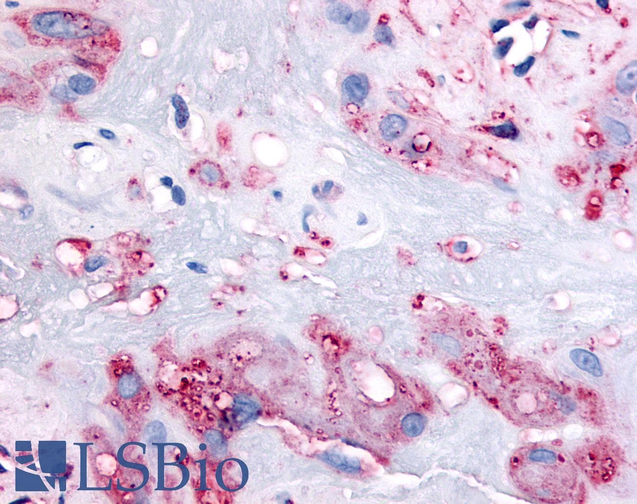 IHC-plus™ Polyclonal Rabbit anti-Human RARB / RAR Beta Antibody (C-Terminus, IHC)