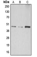 ABHD8 Antibody (Internal)
