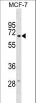 Polyclonal Rabbit anti-Human GGT6 Antibody (aa23-49, WB)