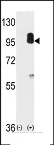Polyclonal Rabbit anti-Human PRKG2 / CGKII Antibody (aa714-744, IHC, WB)