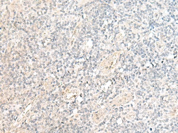 SNRPD1 / SMD1 Antibody