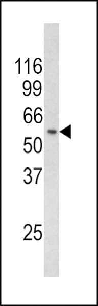 RCBTB2 Antibody (aa71-99)
