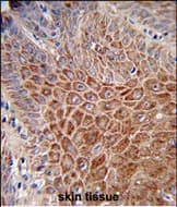 IGHA1 / IgA1 Antibody (aa 290-320, C-Term)