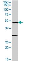 Monoclonal Mouse anti-Human SRF / Serum Response Factor Antibody (clone 2C9, WB)