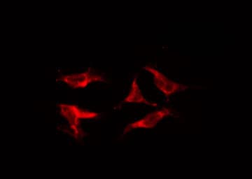 ABAT Antibody