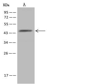 ZADH2 Antibody