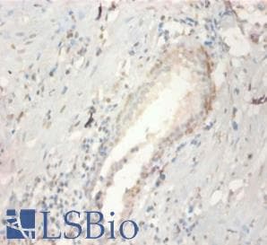 FGF21 Antibody