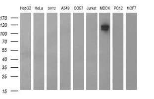 Monoclonal Mouse anti-Human CD44 Antibody (clone OTI5B5, IHC, IF, WB)