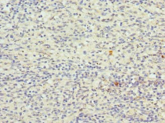 Polyclonal Rabbit anti-Human CDKN2D / p19 INK4d Antibody (IHC)