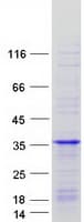 Human RIT1 Protein (Recombinant Myc-DDK (Flag))