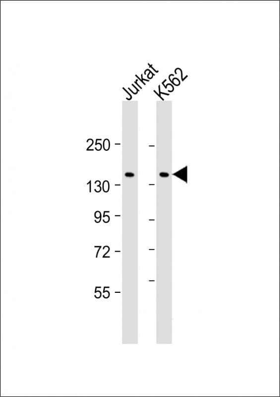KANK1 Antibody (clone 1773CT634.49.61)