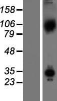 Human AXIN1 / Axin-1 Protein (Over-Expression Lysate Myc-DDK (Flag))