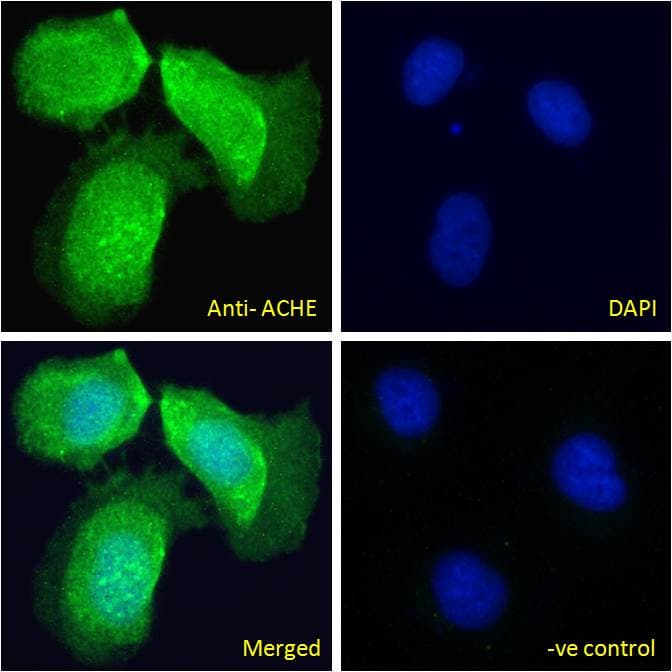 Polyclonal Goat anti-Human ACHE / Acetylcholinesterase Antibody (aa601-614, IF, WB)