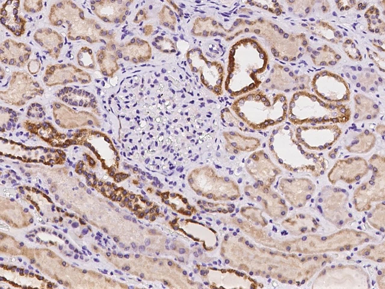 Polyclonal Rabbit anti-Human RAB7A / RAB7 Antibody (IHC, IF)