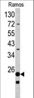 RPS9 / Ribosomal Protein S9 Antibody (aa135-164)