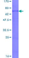 Human MCAD / ACADM Protein (Recombinant GST)