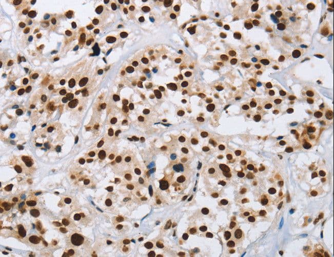 IL17C Antibody