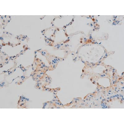 CREB1 / CREB Antibody (phospho-Ser142)