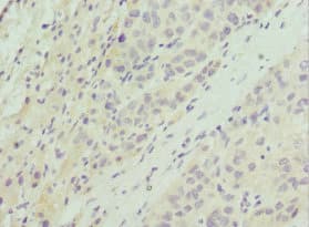 Polyclonal Rabbit anti-Human AKT1S1 / PRAS40 Antibody (IHC)