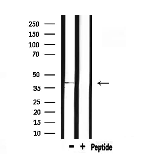 ACP5 / TRAP Antibody