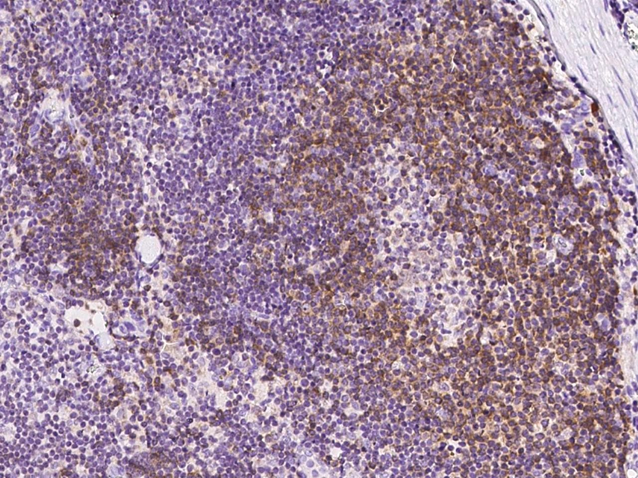 Polyclonal Rabbit anti-Human PTPN6 / SHP1 Antibody (IHC, WB)