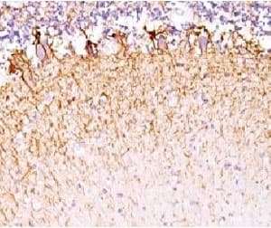 Neurofilament Antibody (clone MSI27-1)