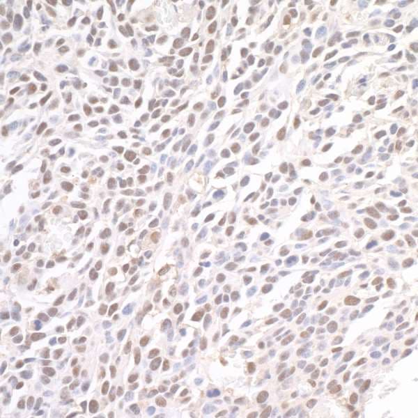 BRD4 Antibody (aa1312-1362)