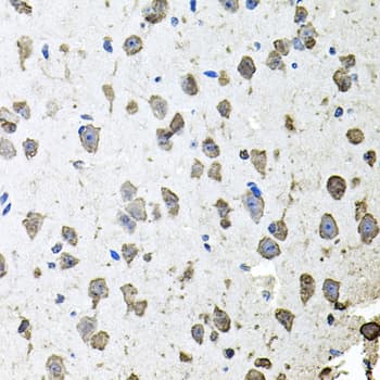 FGF1 / Acidic FGF Antibody