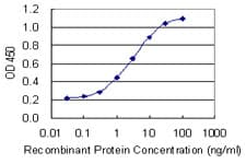 NFKBIA / IKB Alpha / IKBA Antibody (clone 3H4)