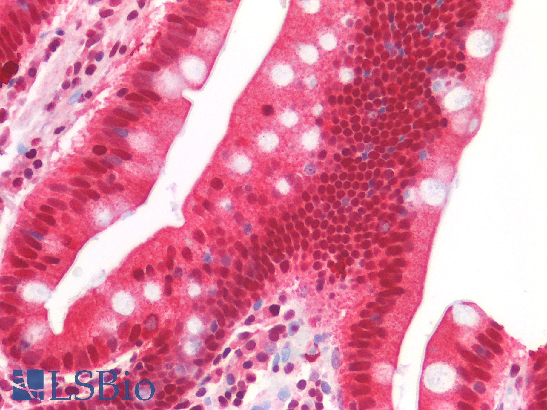 IHC-plus™ SUV420H1 Antibody (Preservative Free)