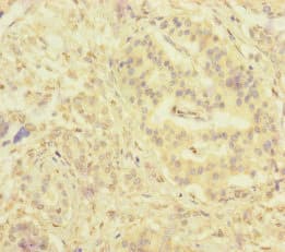 Polyclonal Rabbit anti-Human SERPINB6 / PI-6 Antibody (IHC, WB)