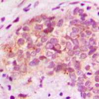 BRP44L Antibody (N-Terminus)