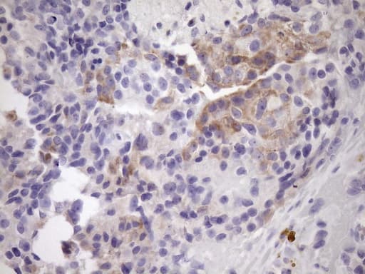 NOBOX Antibody (aa1-271, clone OTI8C7)