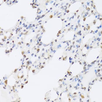 SFN / Stratifin / 14-3-3 Sigma Antibody