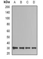 TPI1 / TPI Antibody