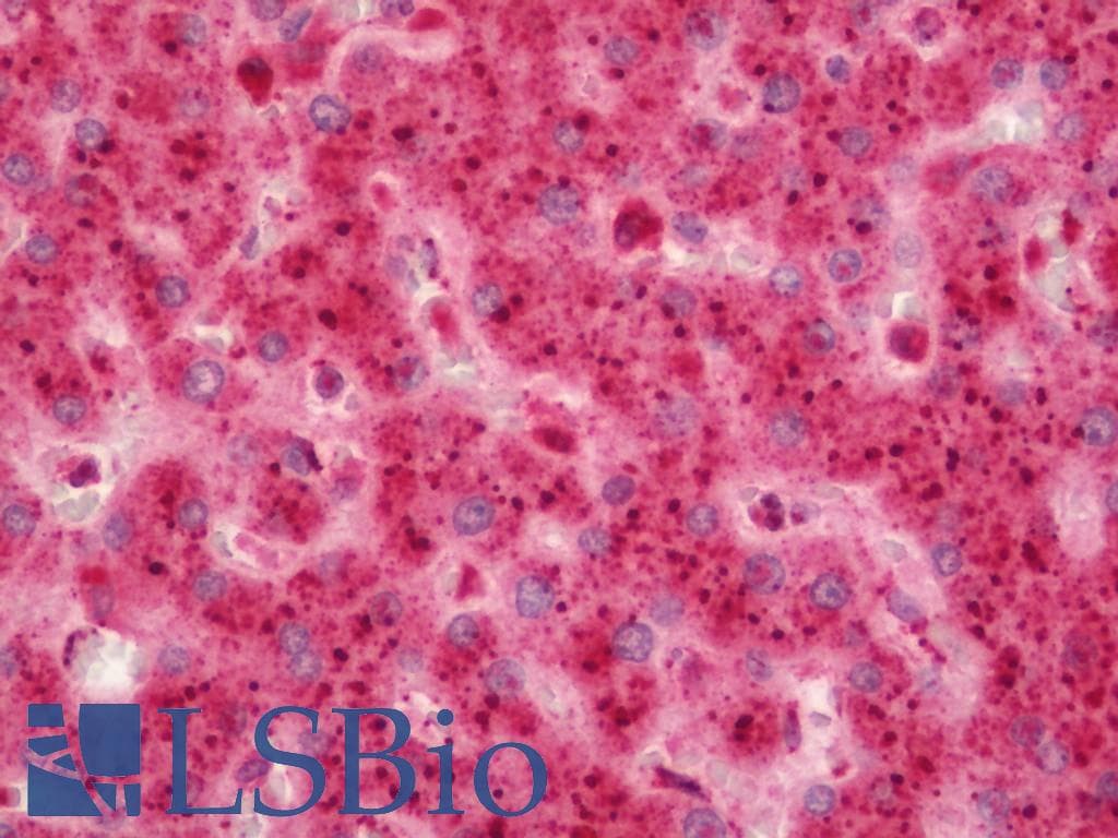 GALNS / Chondroitinase Antibody (Biotin)