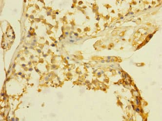 Polyclonal Rabbit anti-Human Betaglycan / TGFBR3 Antibody (IHC, WB)