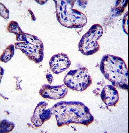 TM4SF18 Antibody (aa113-141)