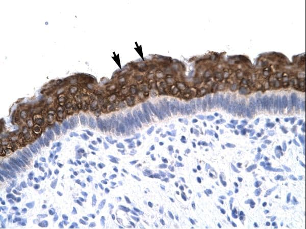 ACLP / AEBP1 Antibody (aa85-134)