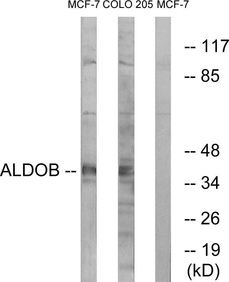 ALDOB Antibody