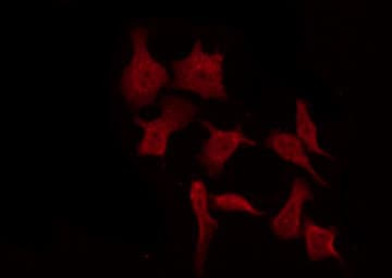 Polyclonal Rabbit anti-Human EGFR Antibody (IF, WB)